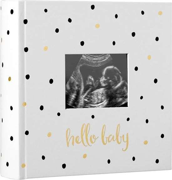 Pearhead Hello Baby Photo Album, Keepsake Book for New and Expecting Parents